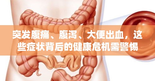 突發(fā)腹痛、腹瀉、大便出血，這些癥狀背后的健康危機(jī)需警惕！