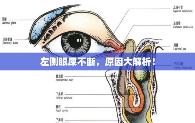 左側(cè)眼屎不斷，原因大解析！