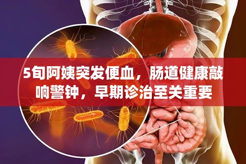 5旬阿姨突發(fā)便血，腸道健康敲響警鐘，早期診治至關(guān)重要