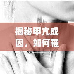 揭秘甲亢成因，如何罹患甲狀腺功能亢進(jìn)？